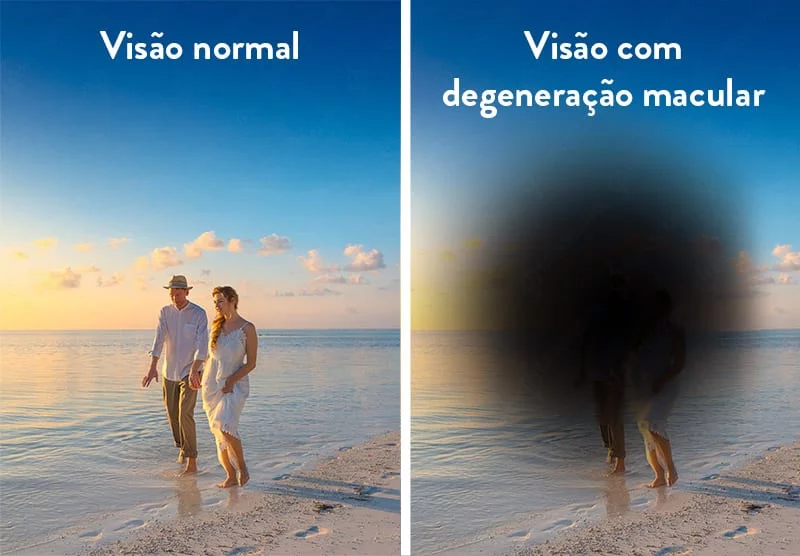 Visão com degeneração macular